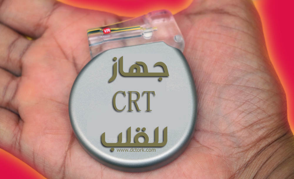 جهاز crt للقلب