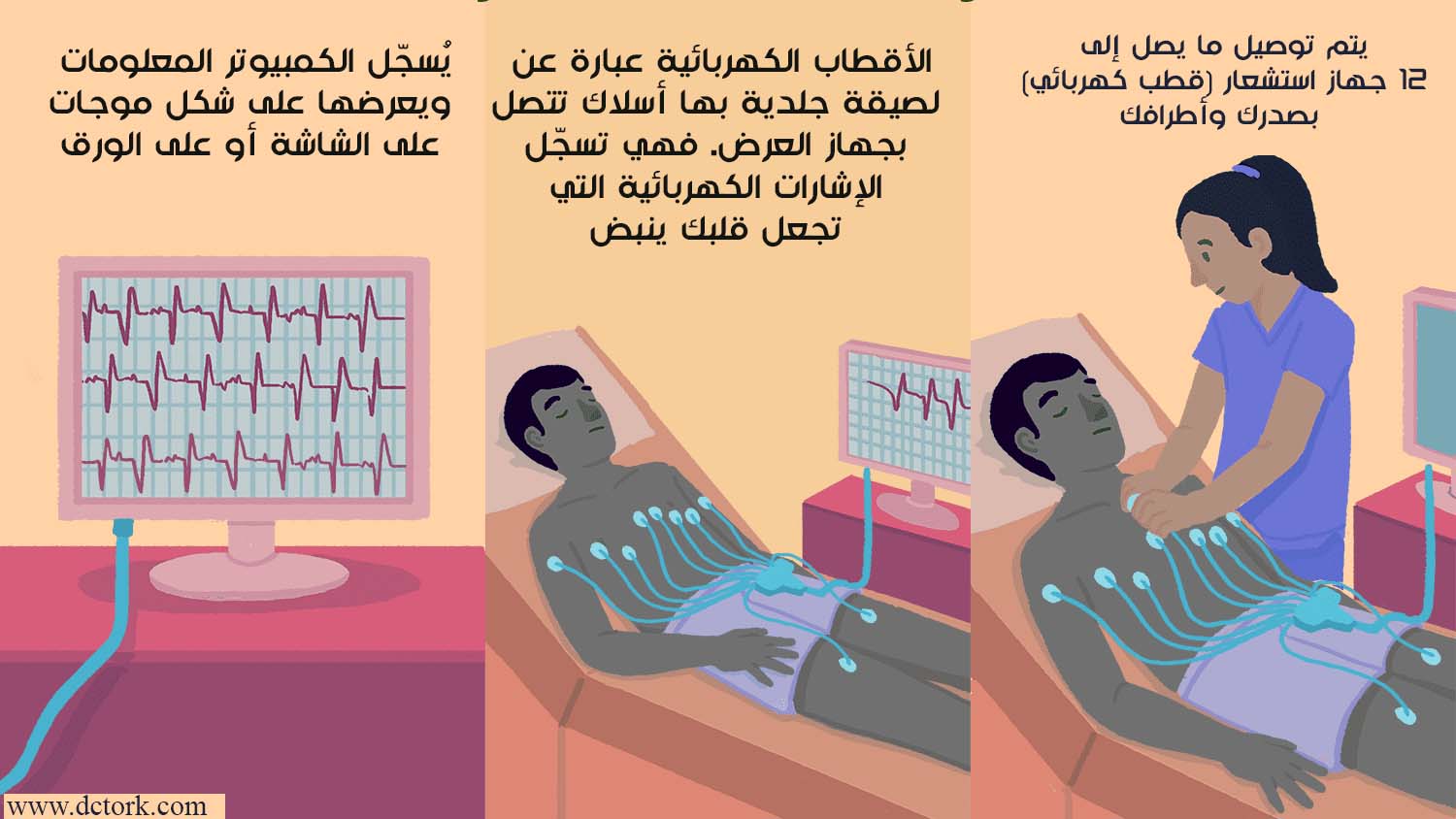 ما هو رسم القلب ECG ؟