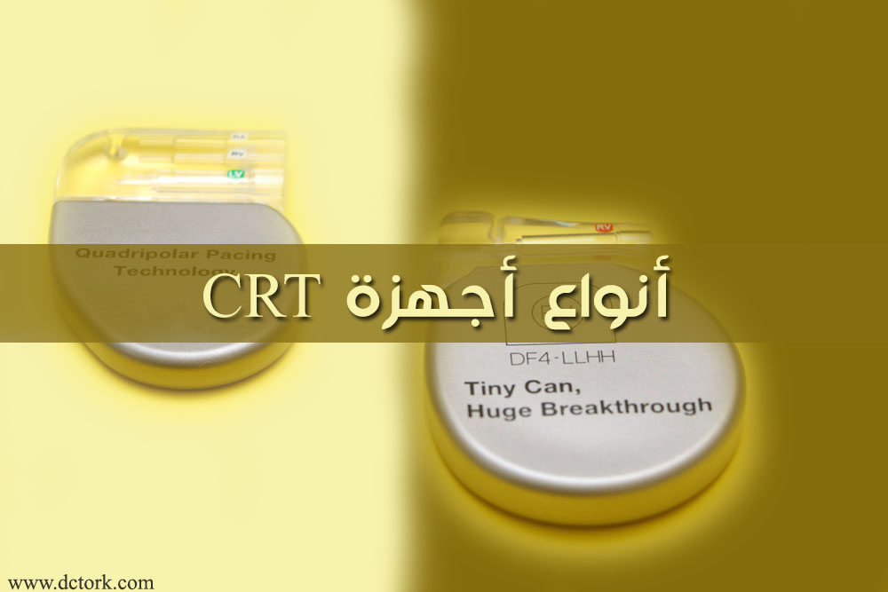 ما هي أنواع أجهزة CRT للقلب ؟