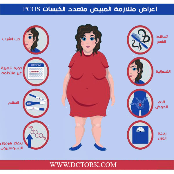 أعراض متلازمة المبيض متعدد الكيسات