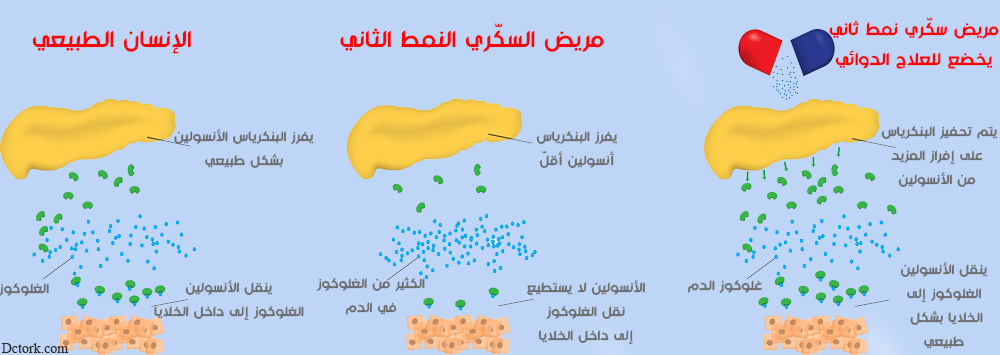 ما هو أفضل منظم للسكر النوع الثاني في الصيدليات ؟