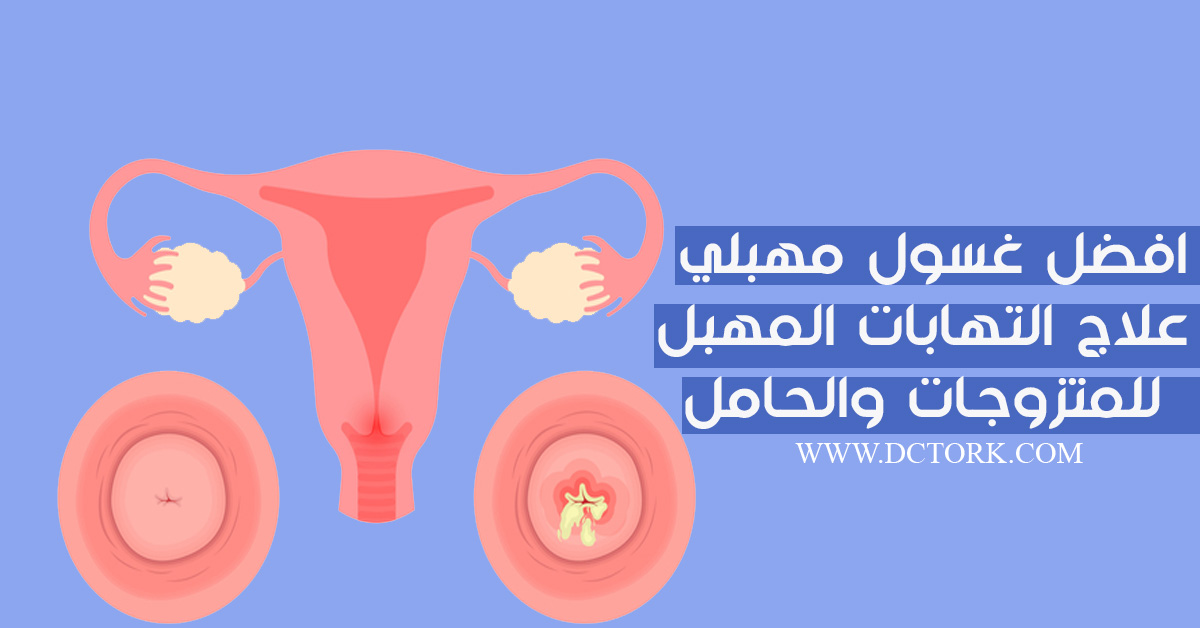 افضل غسول مهبلي علاج التهابات المهبل للمتزوجات والحامل